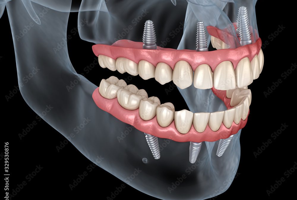 CURE DENTALI