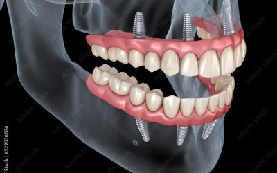 CURE DENTALI
